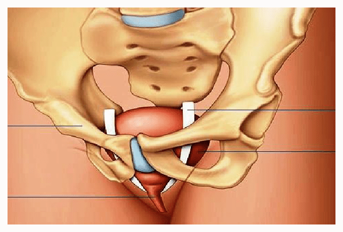 especialista em incontinencia-urinaria sp
